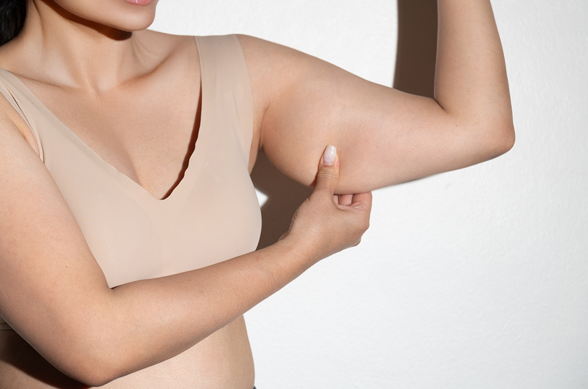 a woman pinches her upper arm to examine body fat