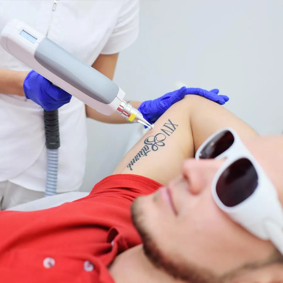 tattoo removal neodymium laser in the beauty salon . Laser cosmetology