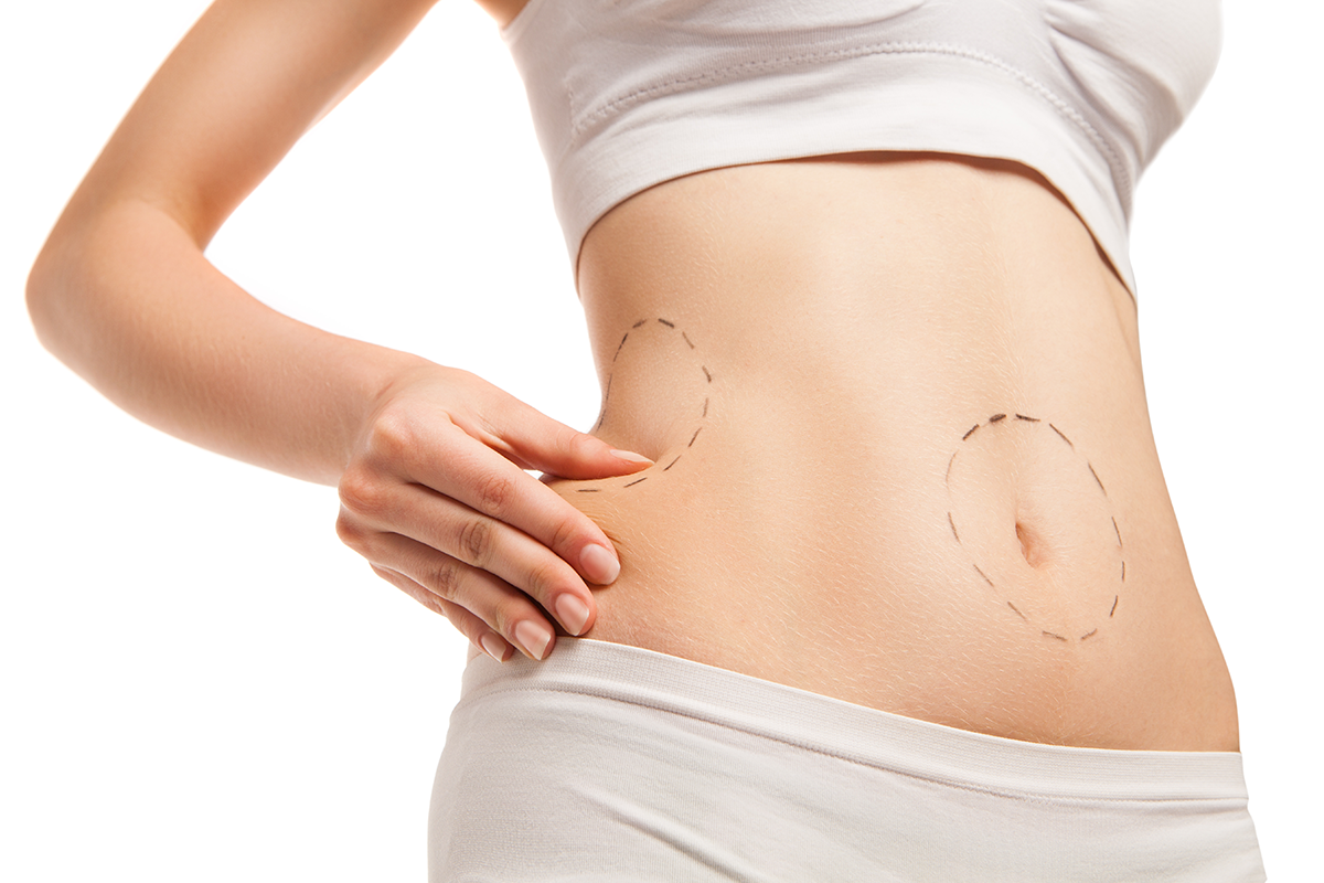 patient with outlines on body in close up