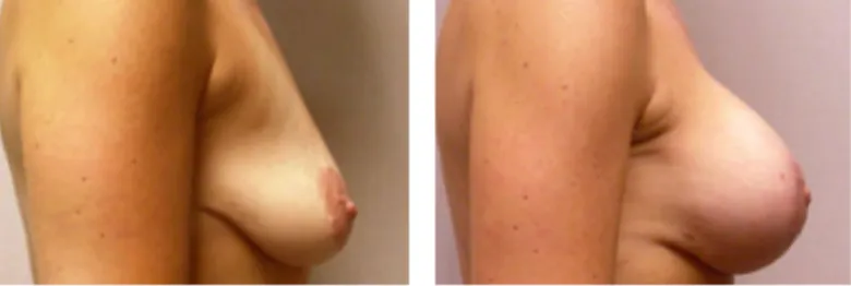 Screenshot at .. PM