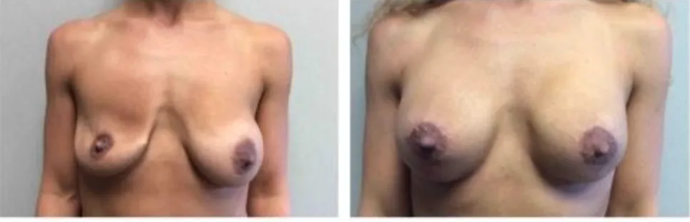 Screenshot at .. PM