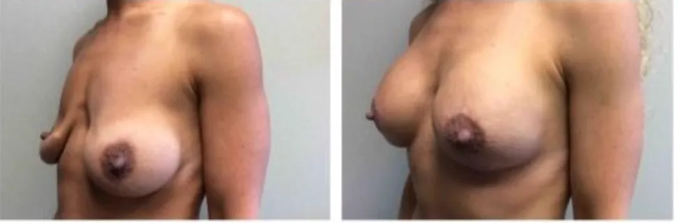 Screenshot at .. PM