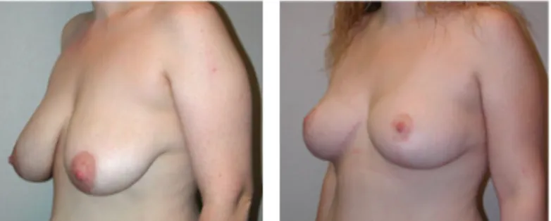 Screenshot at .. PM