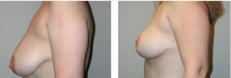 Screenshot at .. PM