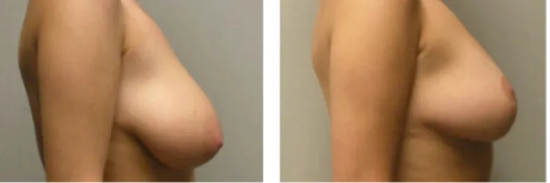 Screenshot at .. PM