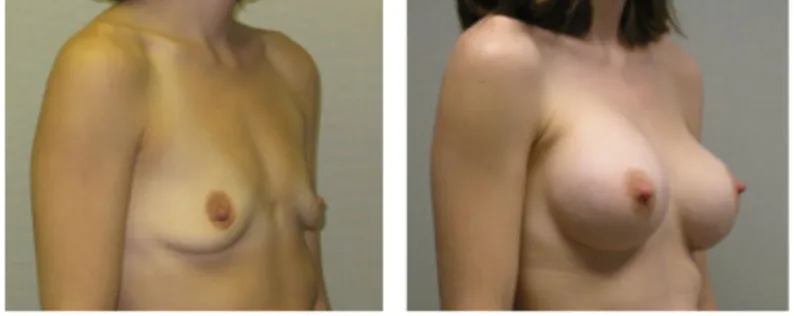 Screenshot at .. PM