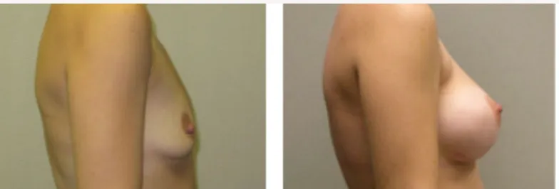 Screenshot at .. PM