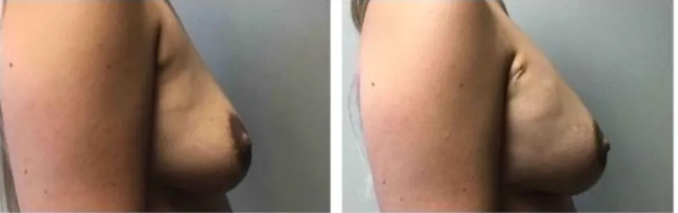 Screenshot at .. PM