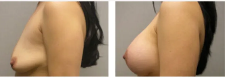 Screenshot at .. PM