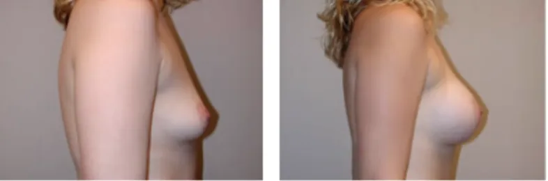 Screenshot at .. PM