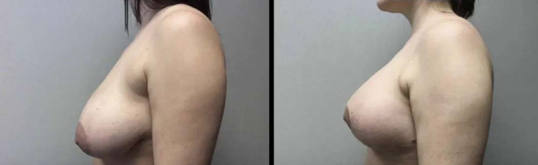 Screenshot at .. PM