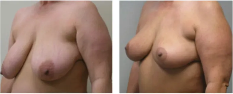 Screenshot at .. PM