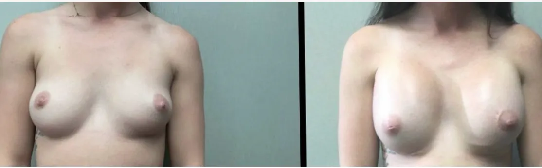 Screenshot at .. PM