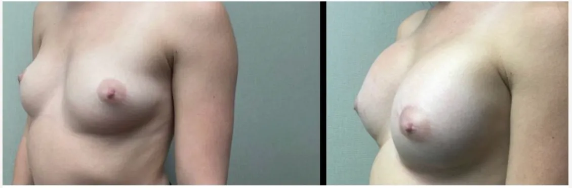 Screenshot at .. PM