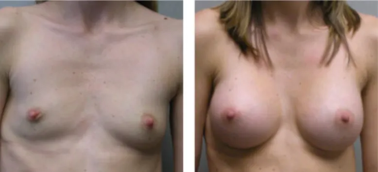 Screenshot at .. PM