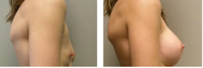 Screenshot at .. PM