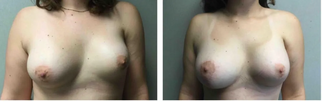 Screenshot at .. PM