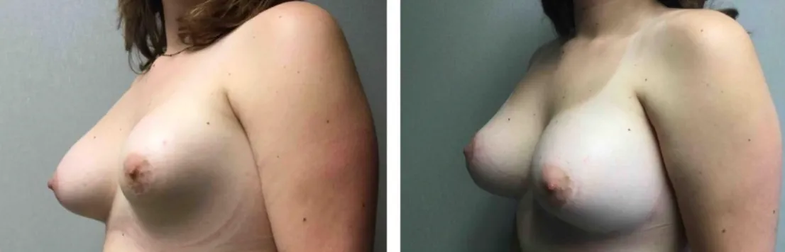 Screenshot at .. PM