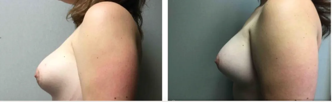 Screenshot at .. PM