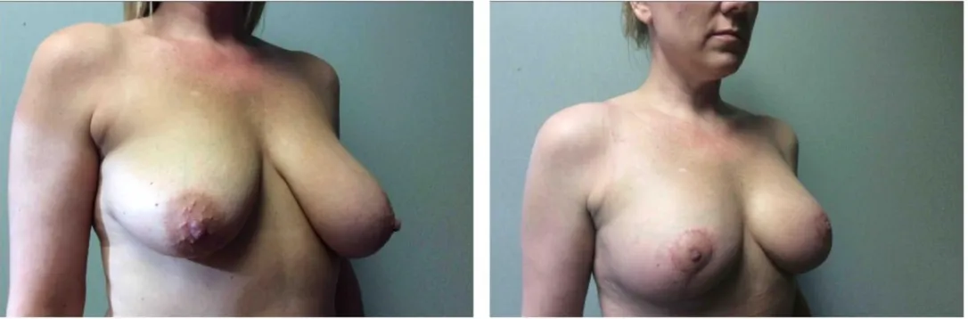 Screenshot at .. PM