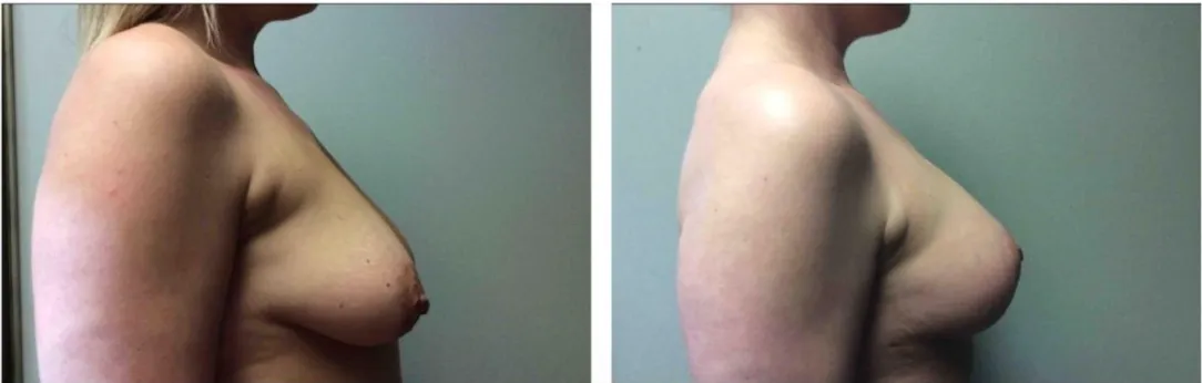 Screenshot at .. PM