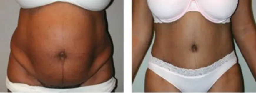 Screenshot at .. PM