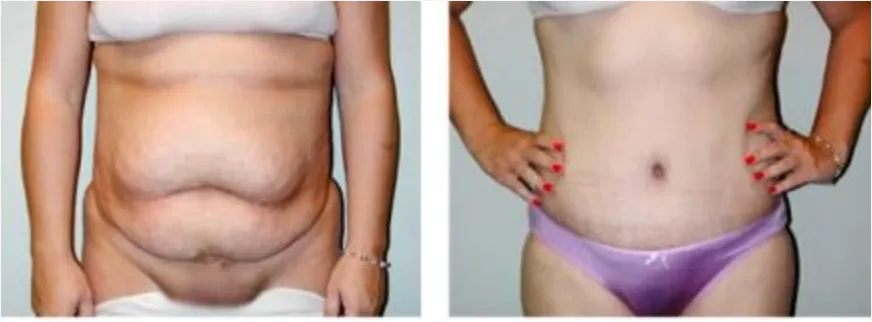 Screenshot at .. PM