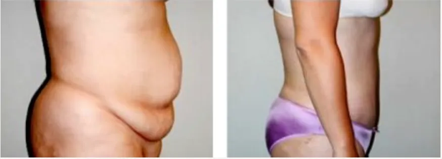 Screenshot at .. PM