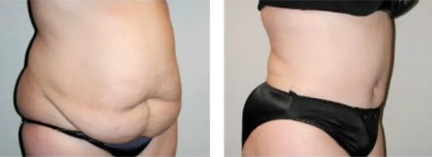 Screenshot at .. PM