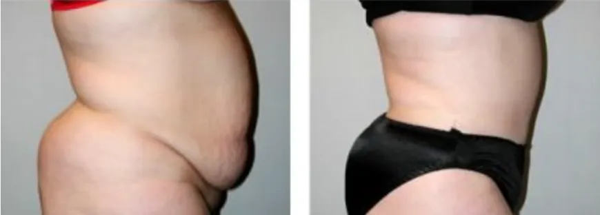 Screenshot at .. PM