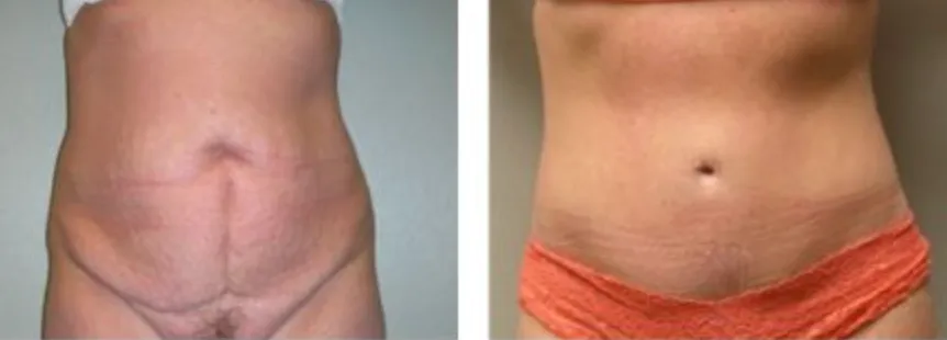 Screenshot at .. PM