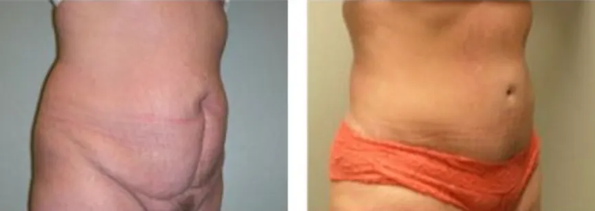 Screenshot at .. PM