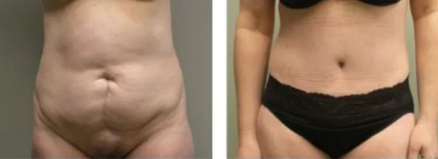 Screenshot at .. PM