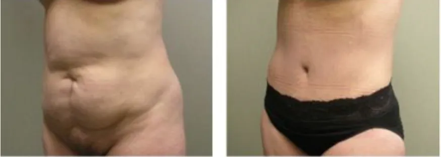 Screenshot at .. PM